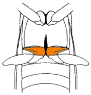 abb113.gif