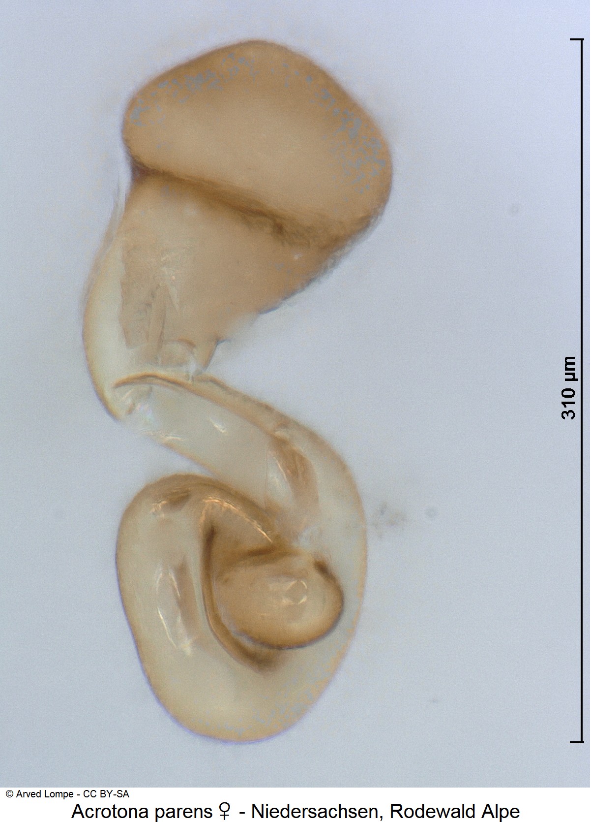 acrotona_parens_w_$30741709_sperm.jpg