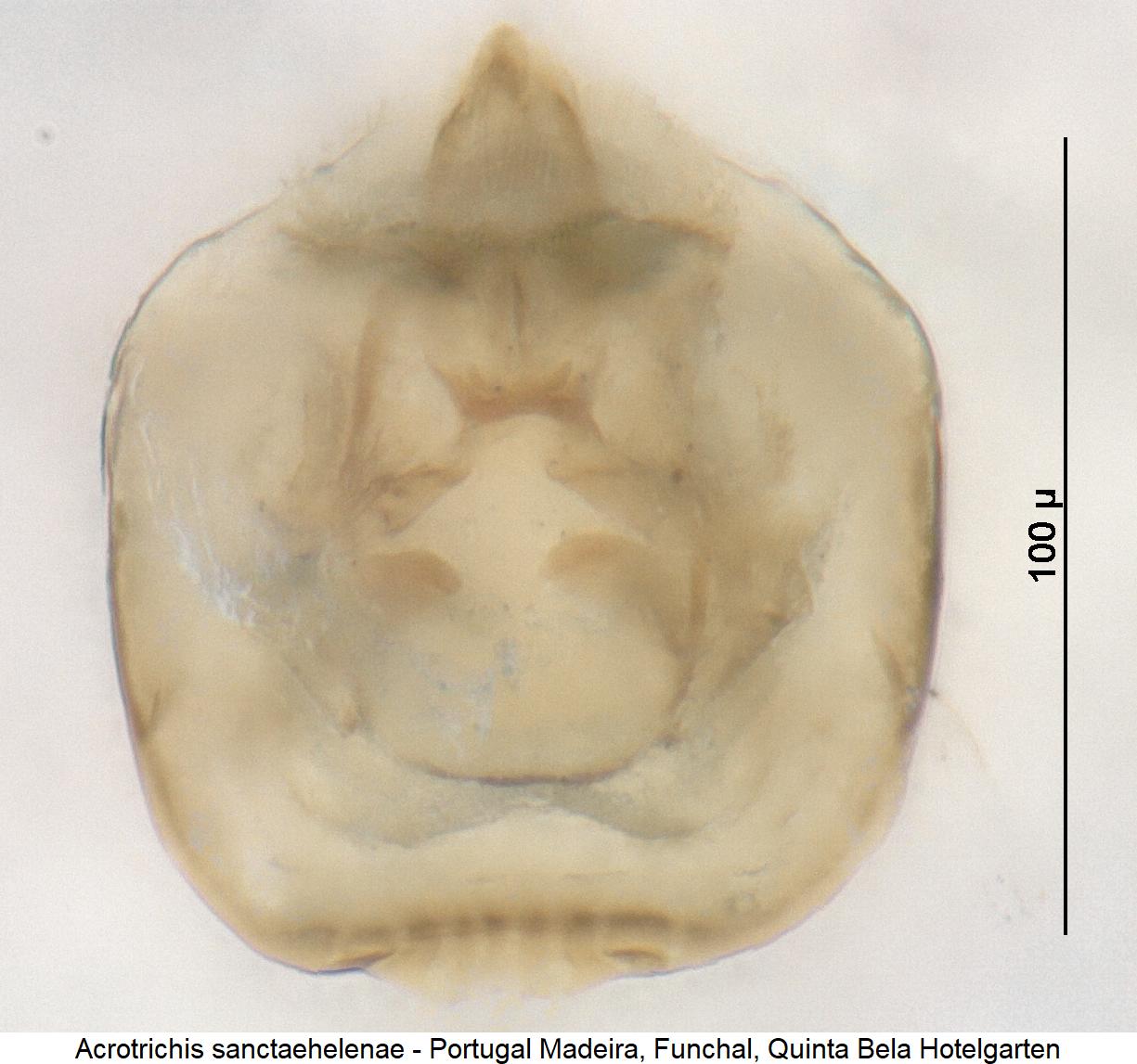 acrotrichis_sanctaehelenae.jpg