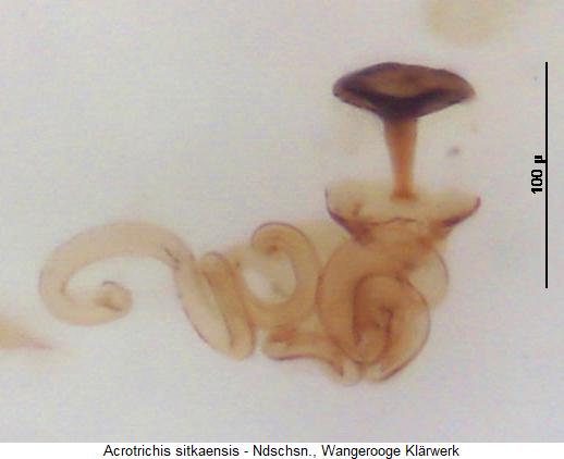 acrotrichis_sitkaensis_sperm3.jpg
