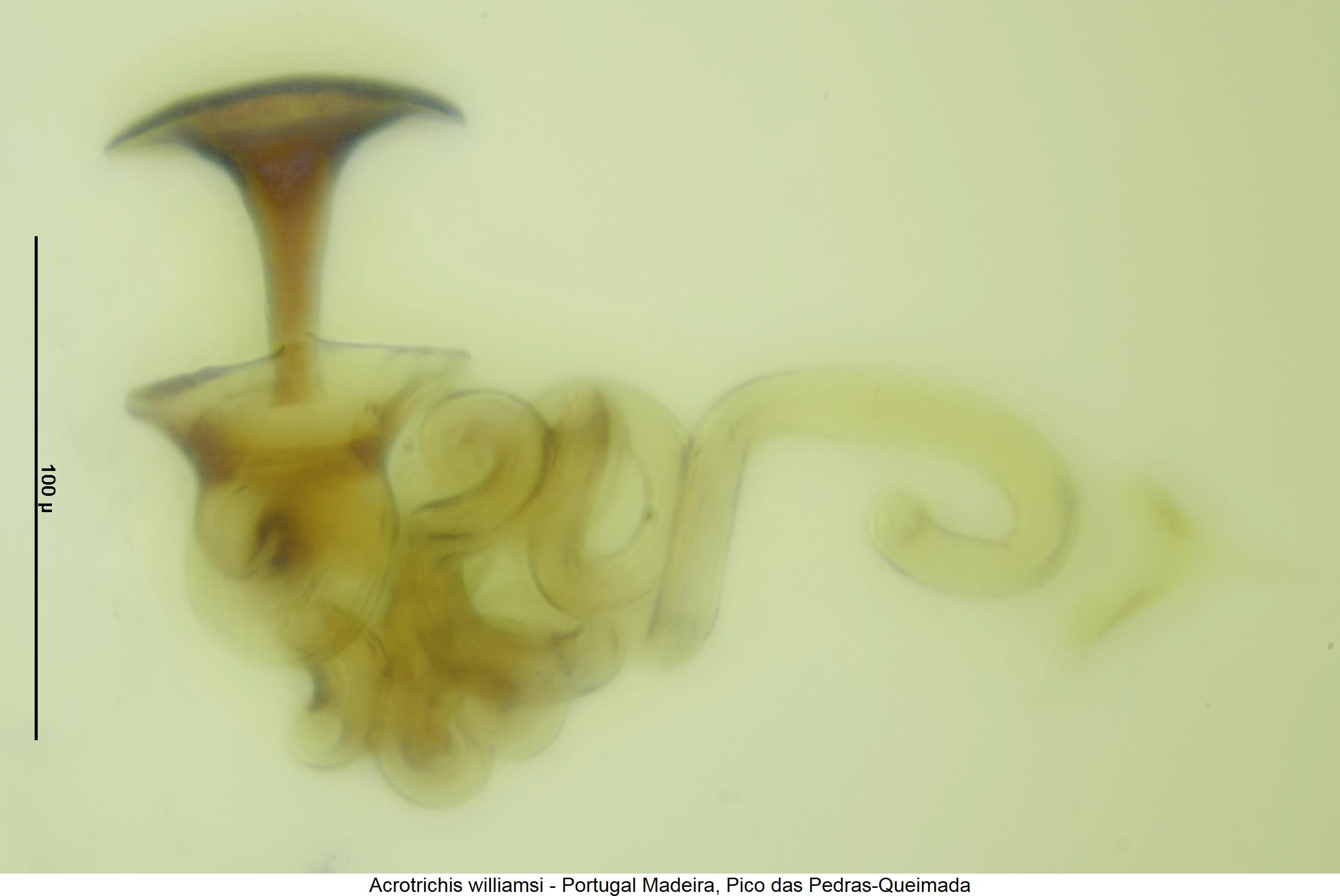 acrotrichis_williamsi_sperm.jpg