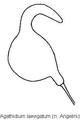 agathidium_laevigatum_sperm.gif