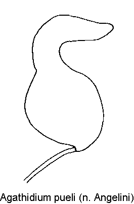 agathidium_pueli_sperm.gif