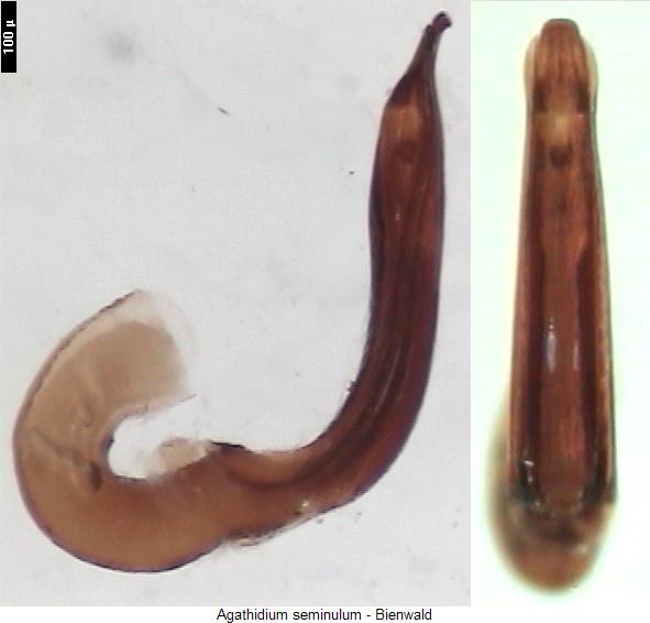 agathidium_seminulum.jpg