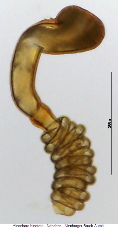 aleochara_binotata_sperm.jpg