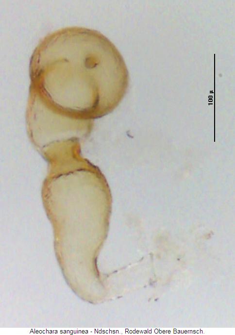 aleochara_sanguinea_sperm.jpg