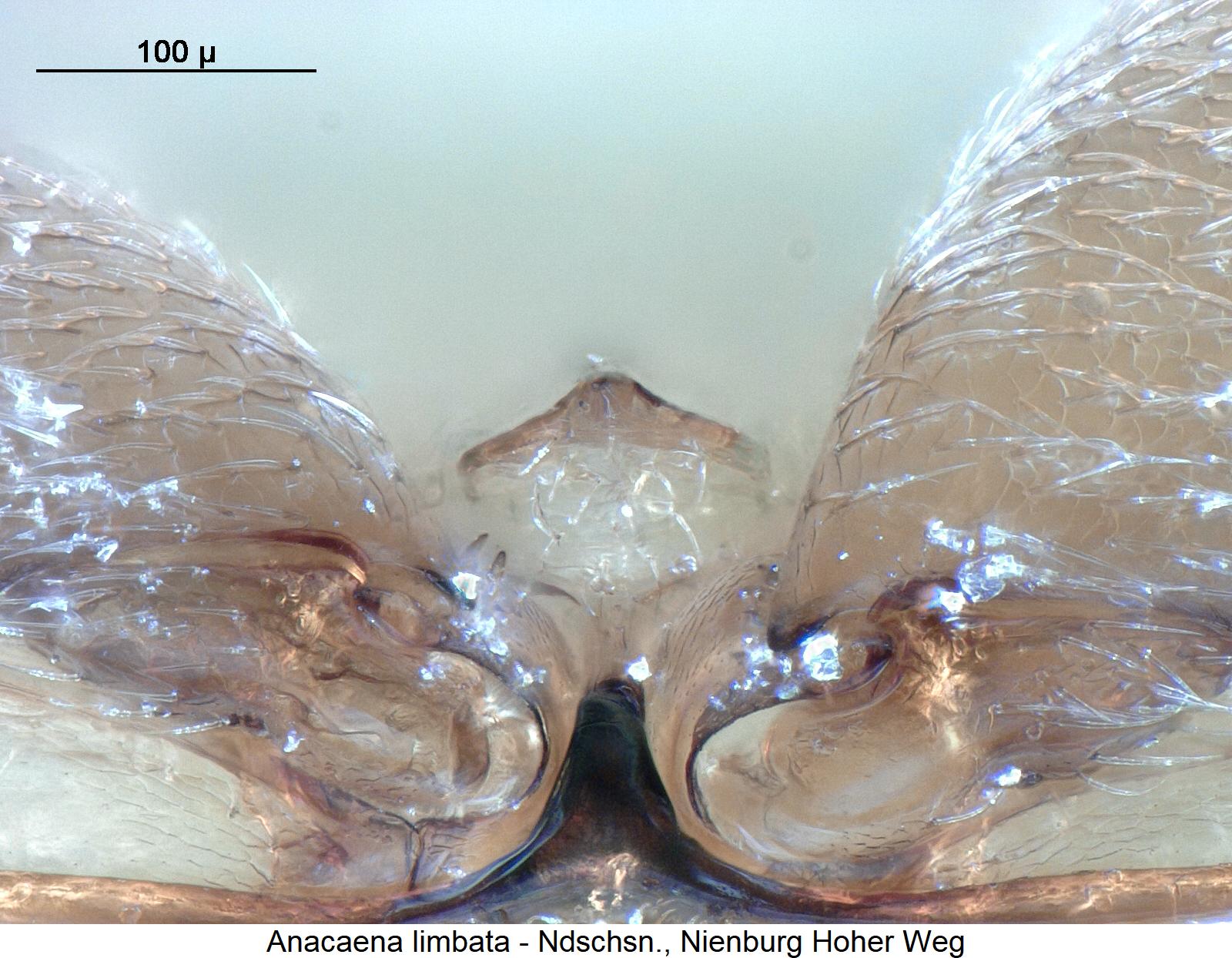 anacaena_limbata_mbr1.jpg