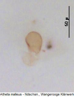 atheta_malleus_sperm.jpg