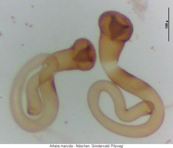 atheta_marcida_sperm.jpg