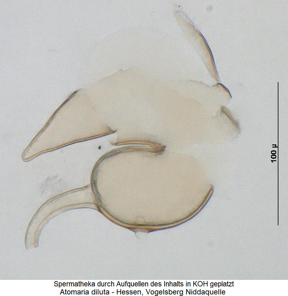 atomaria_diluta_sperm.jpg