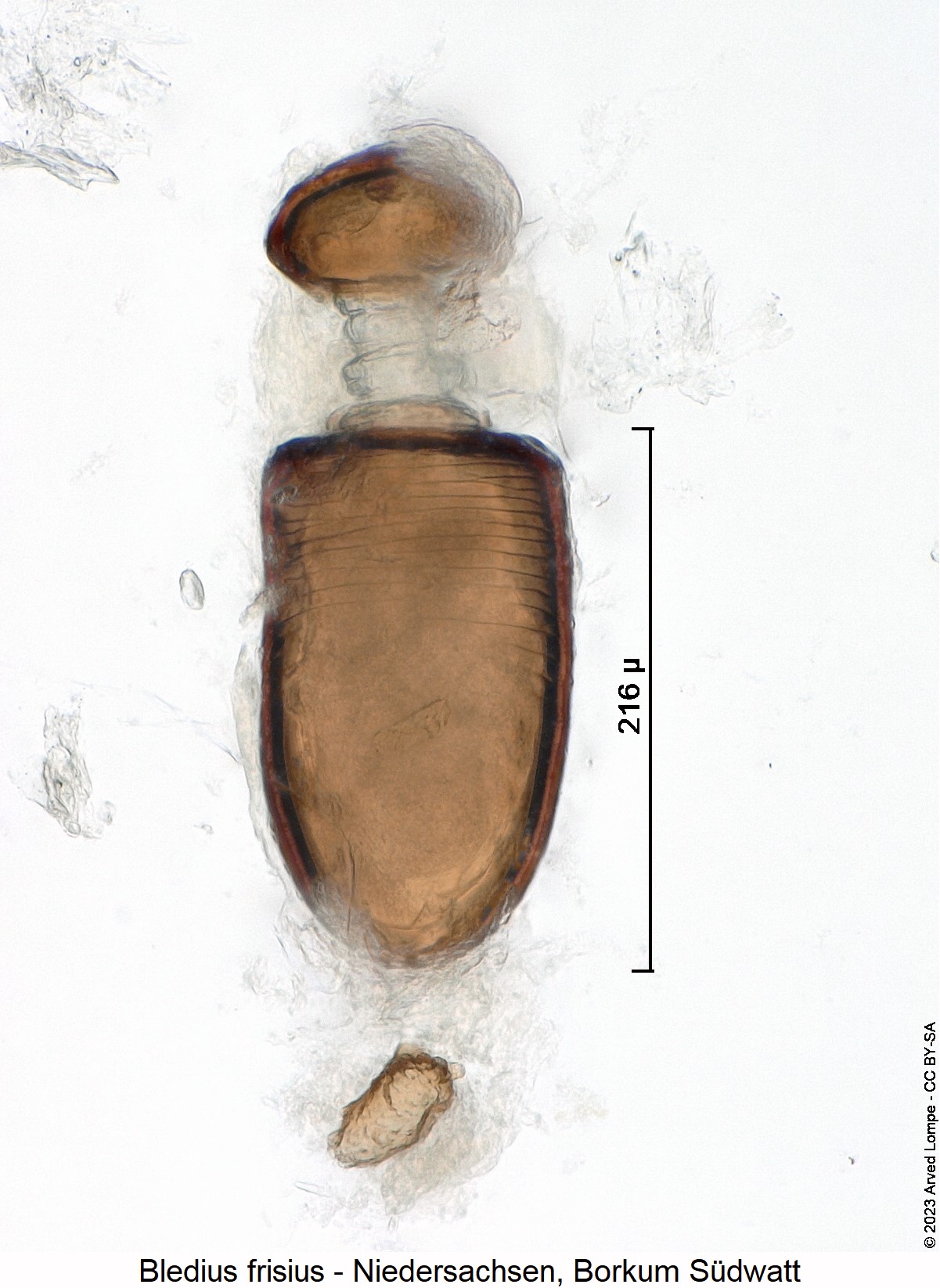 bledius_frisius_sperm1.jpg