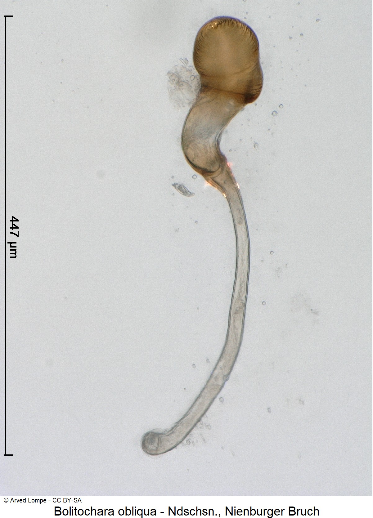 bolitochara_obliqua_ck35584033_sperm.jpg
