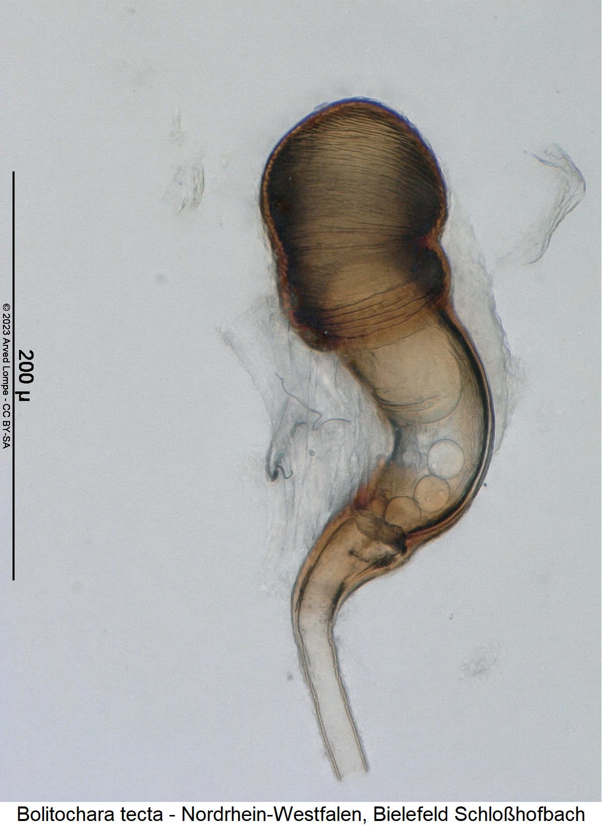 bolitochara_tecta_sperm.jpg