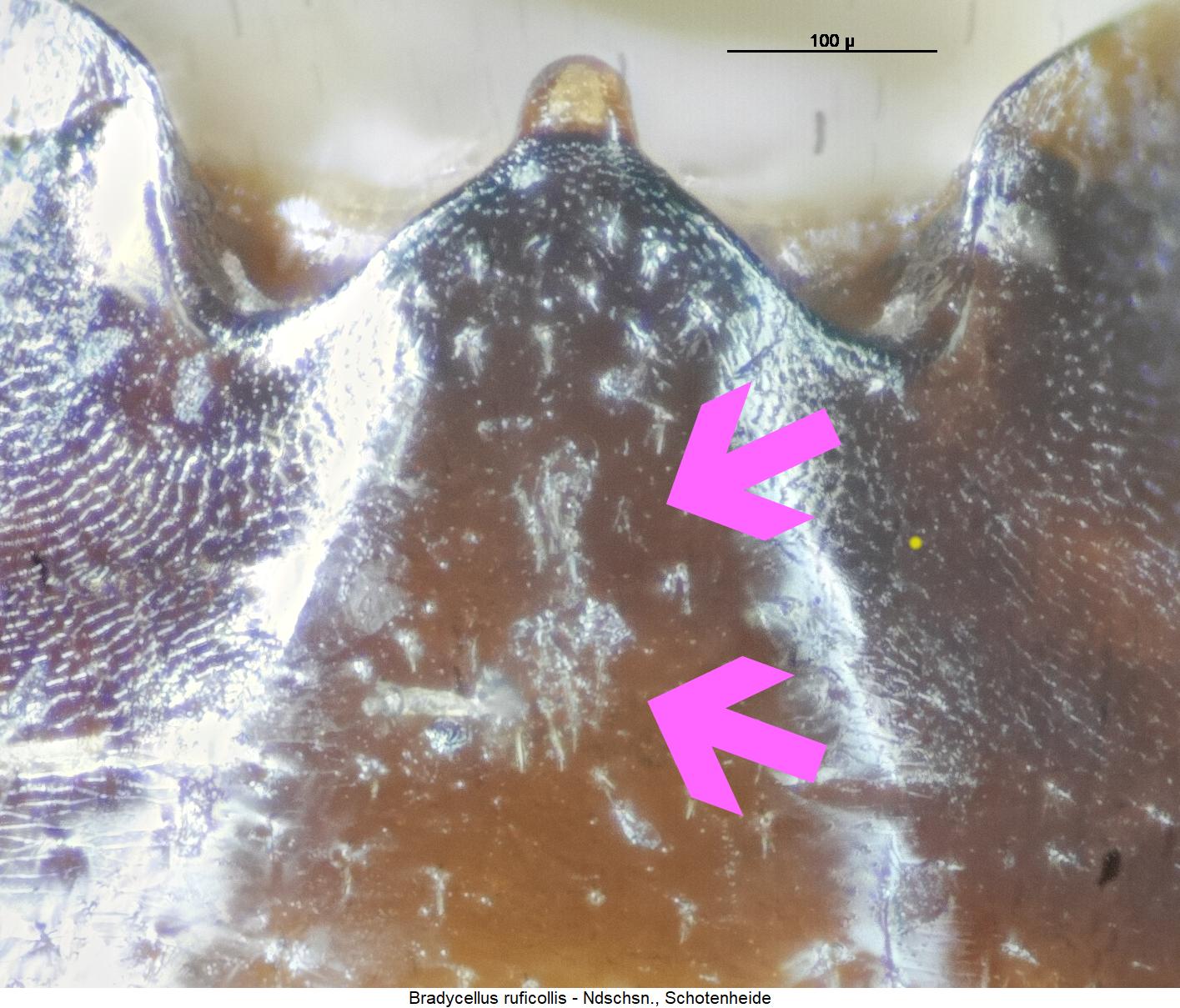 bradycellus_ruficollis_abd1.jpg