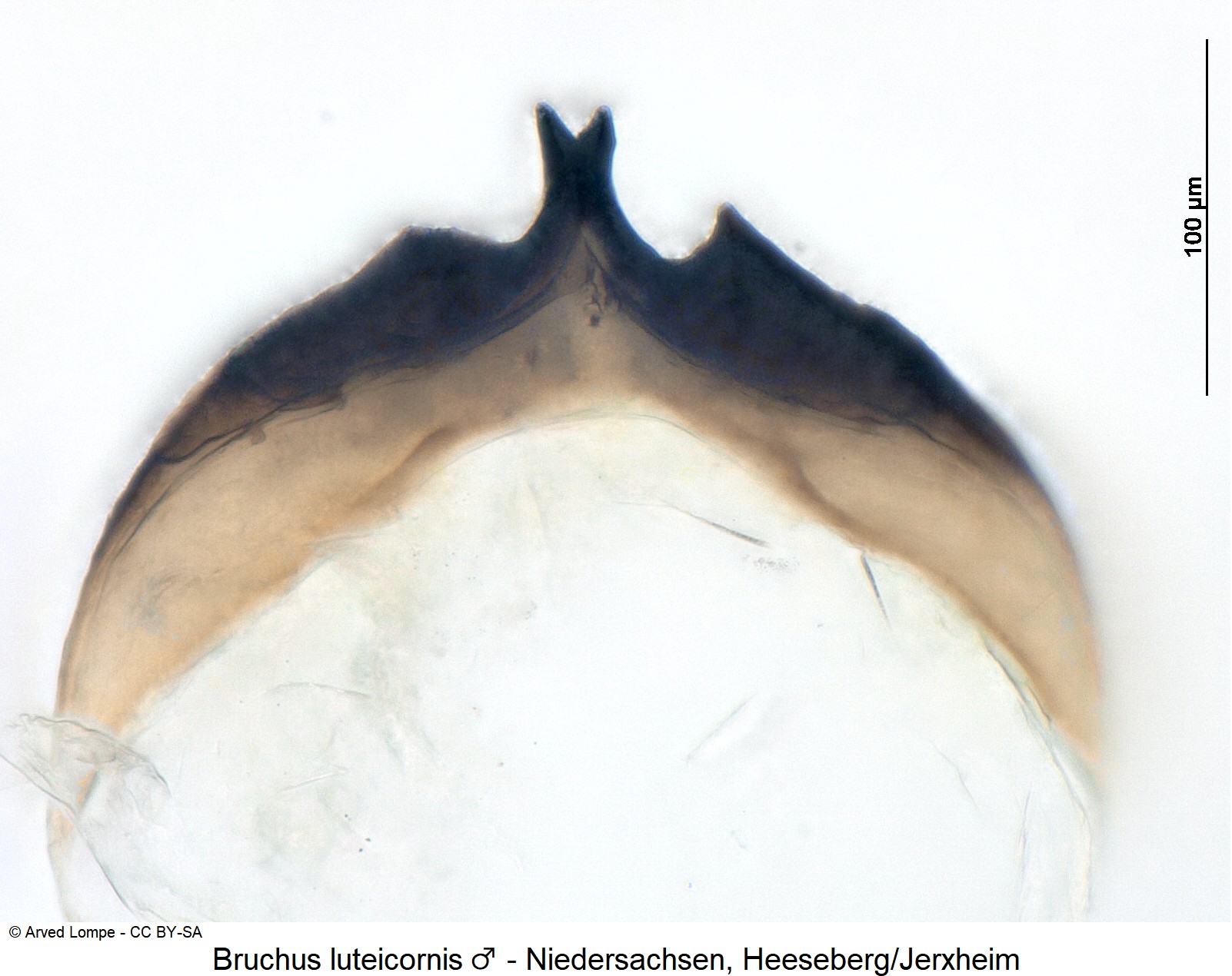 bruchus_luteicornis_m_ck31726469_urosternit.jpg