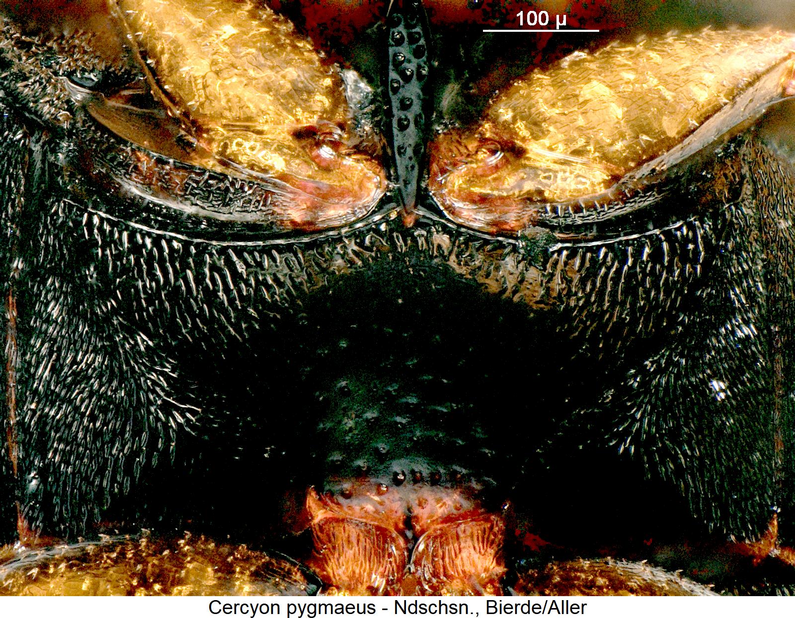 cercyon_pygmaeus_hbr.jpg
