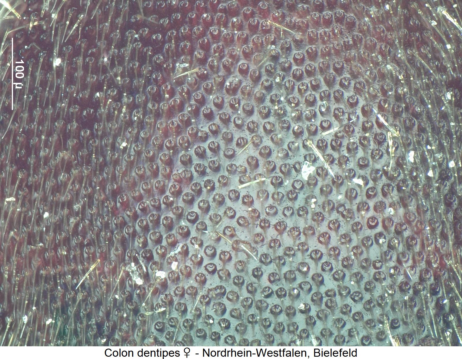 colon_dentipes_w_hsch_ms.jpg