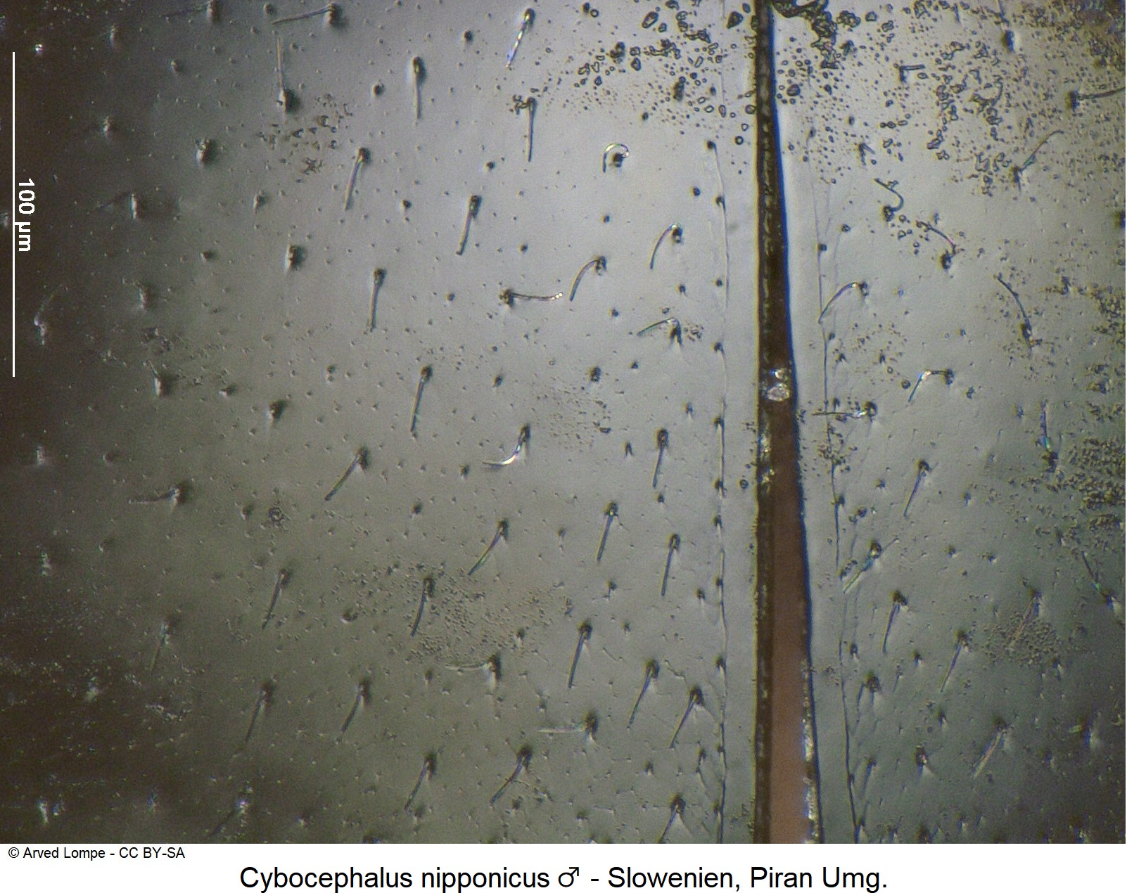cybocephalus_nipponicus_ck37255699_fld_ms.jpg