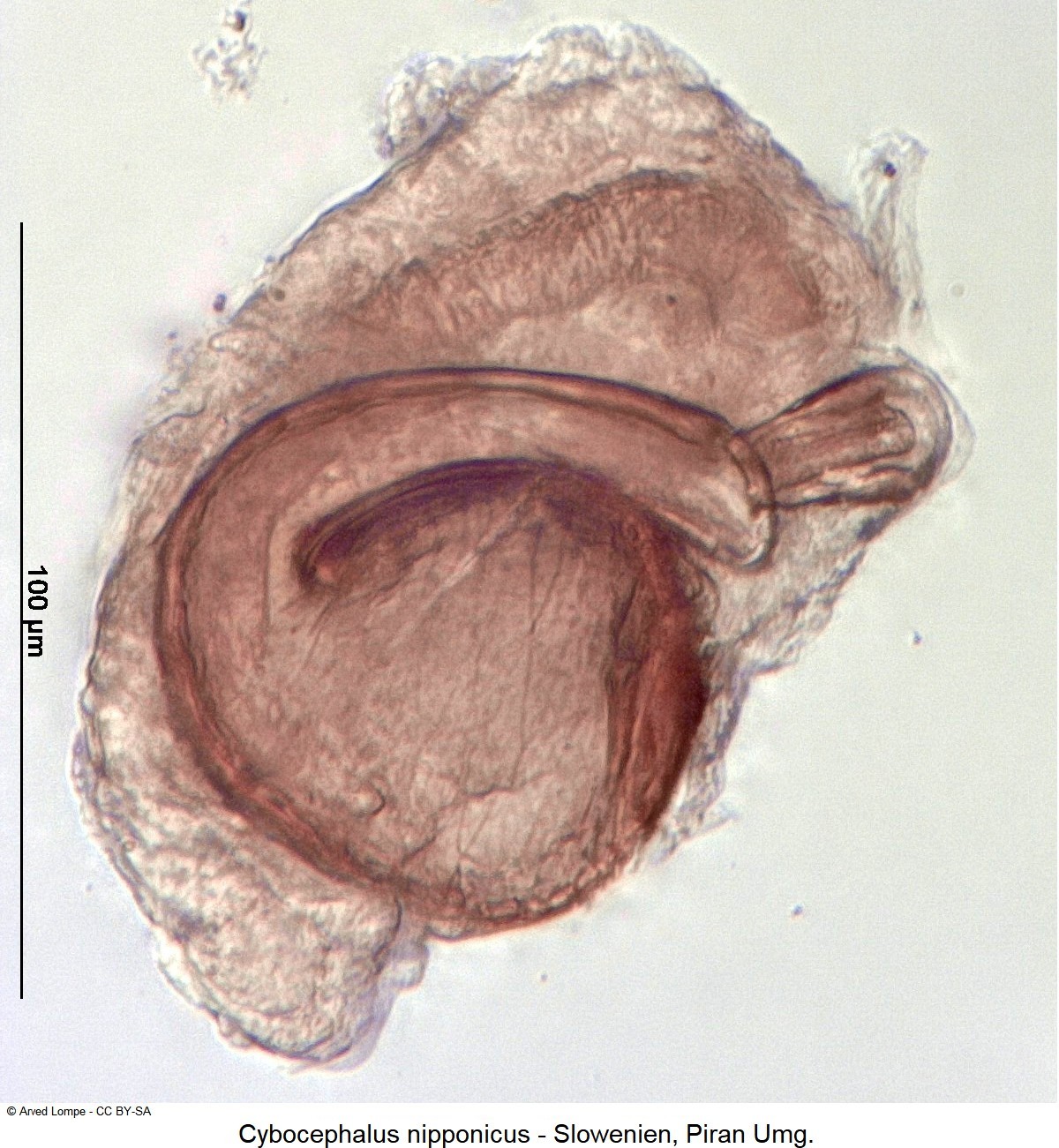 cybocephalus_nipponicus_sperm.jpg