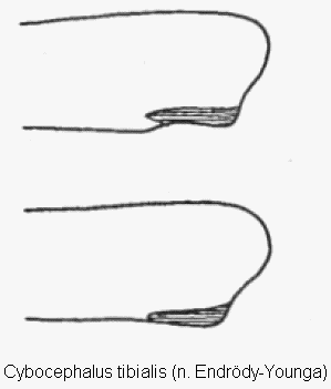 cybocephalus_tibialis_vschn.gif