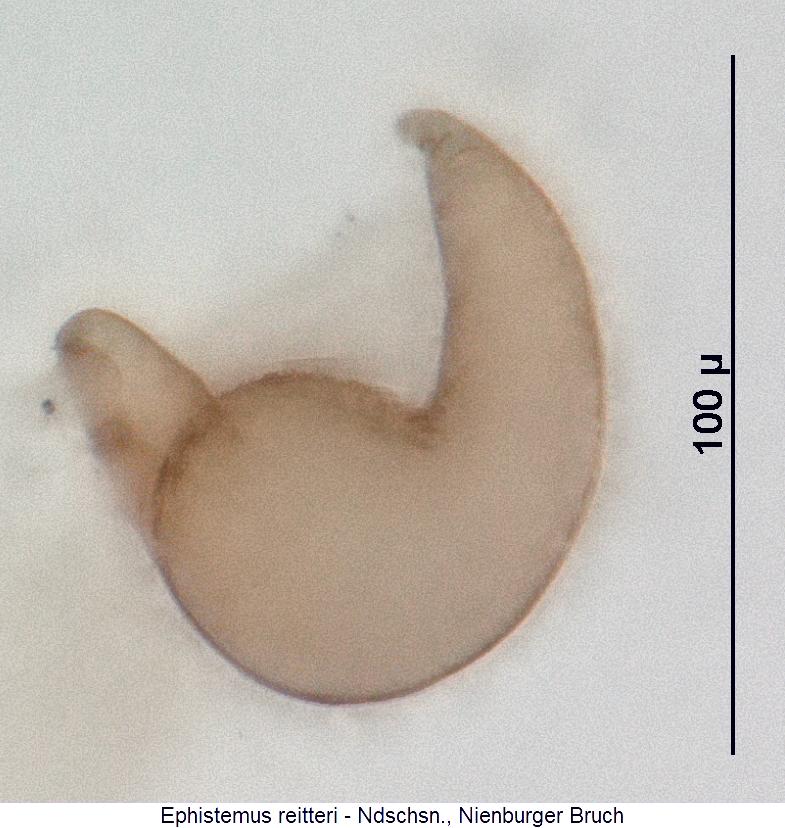 ephistemus_reitteri_sperm.jpg