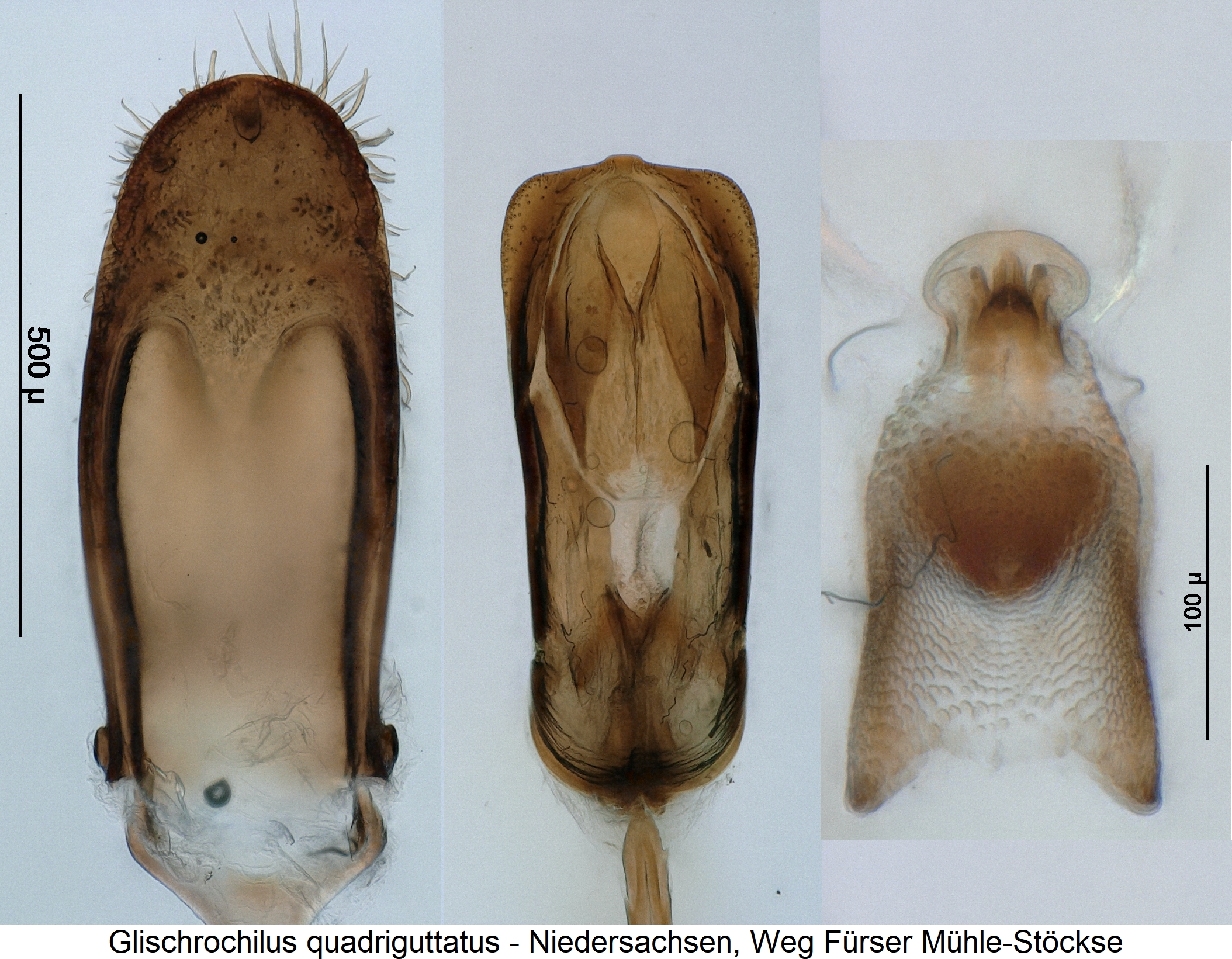 glischrochilus_quadriguttatus1.jpg