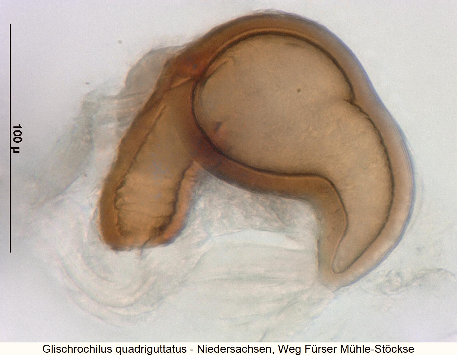 glischrochilus_quadriguttatus_sperm.jpg