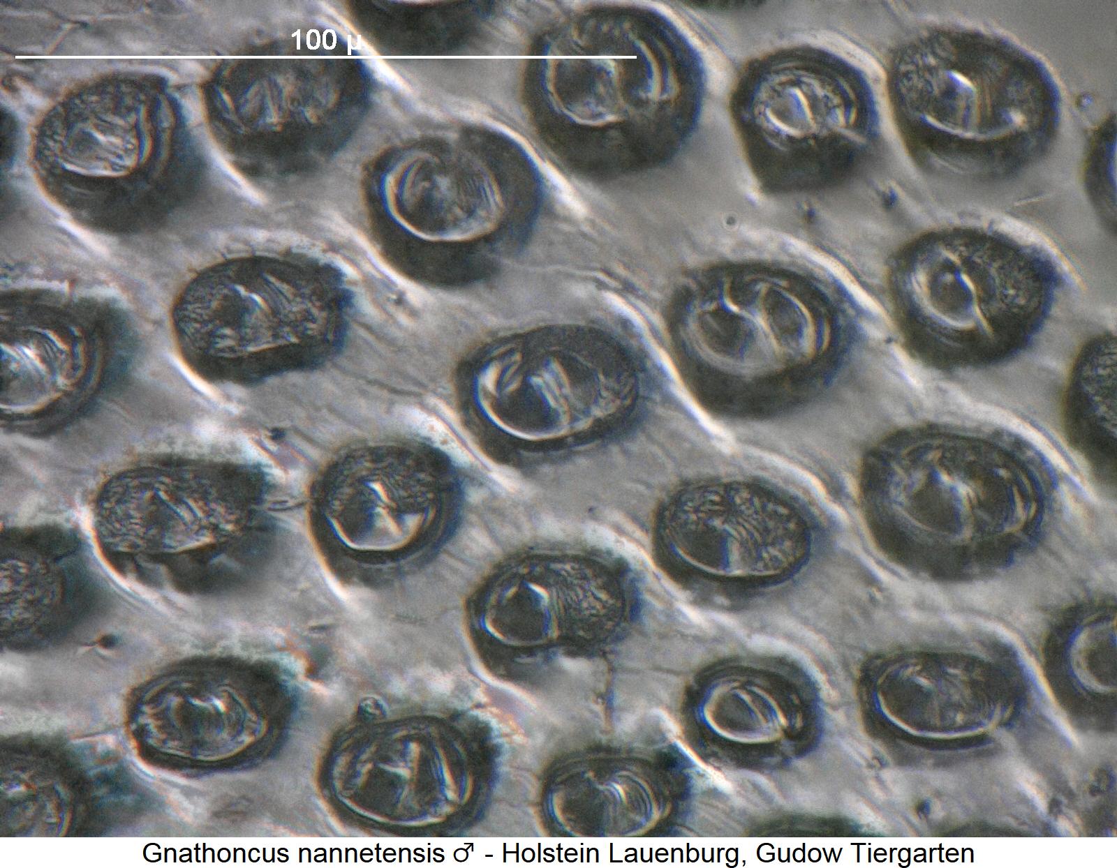 gnathoncus_nannetensis_m_ms.jpg