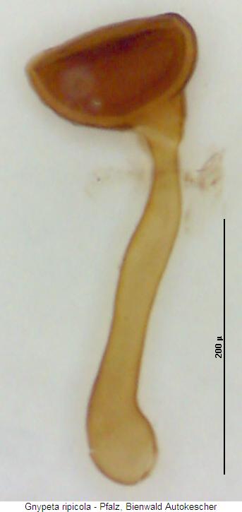 gnypeta_ripicola_sperm.jpg