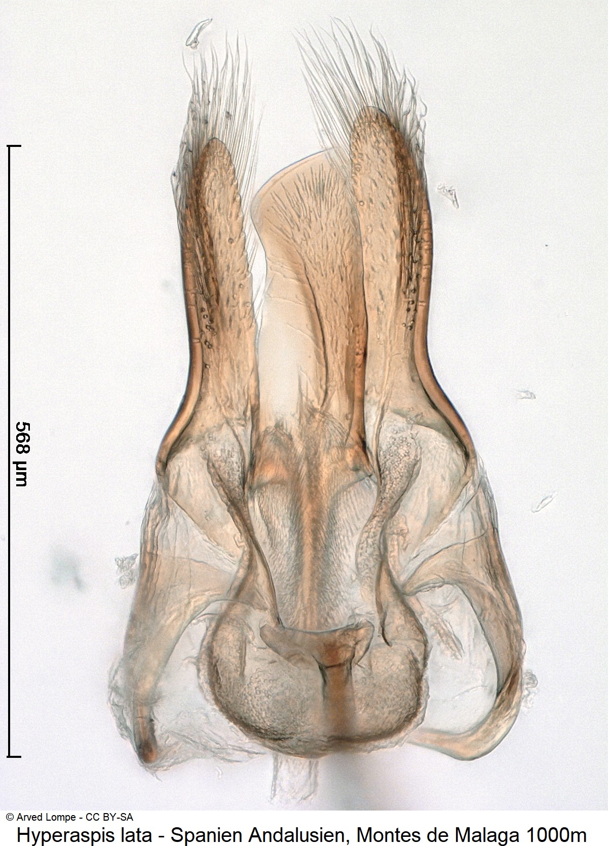 hyperaspis_lata_ck34492210.jpg