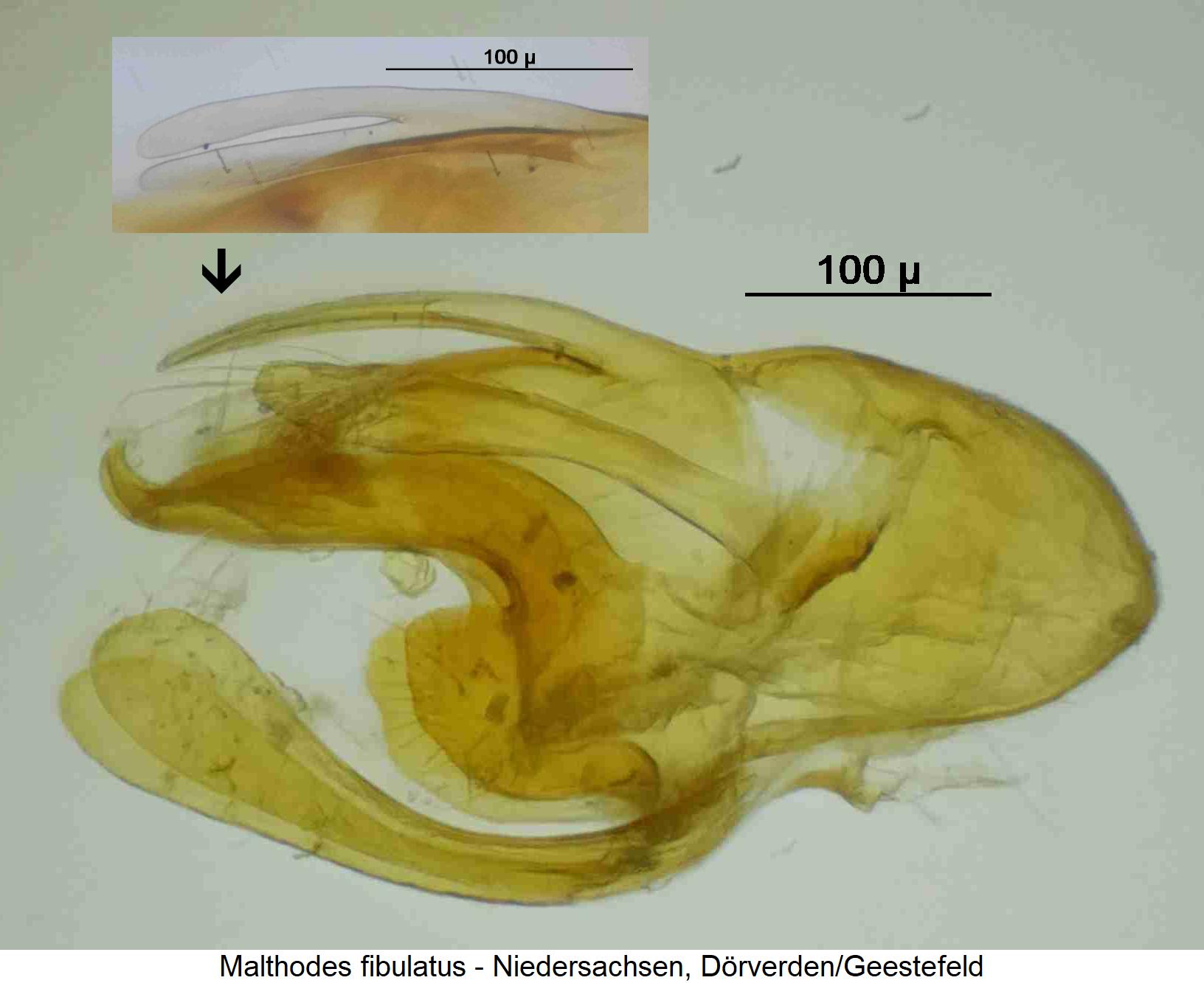 malthodes_fibulatus.jpg