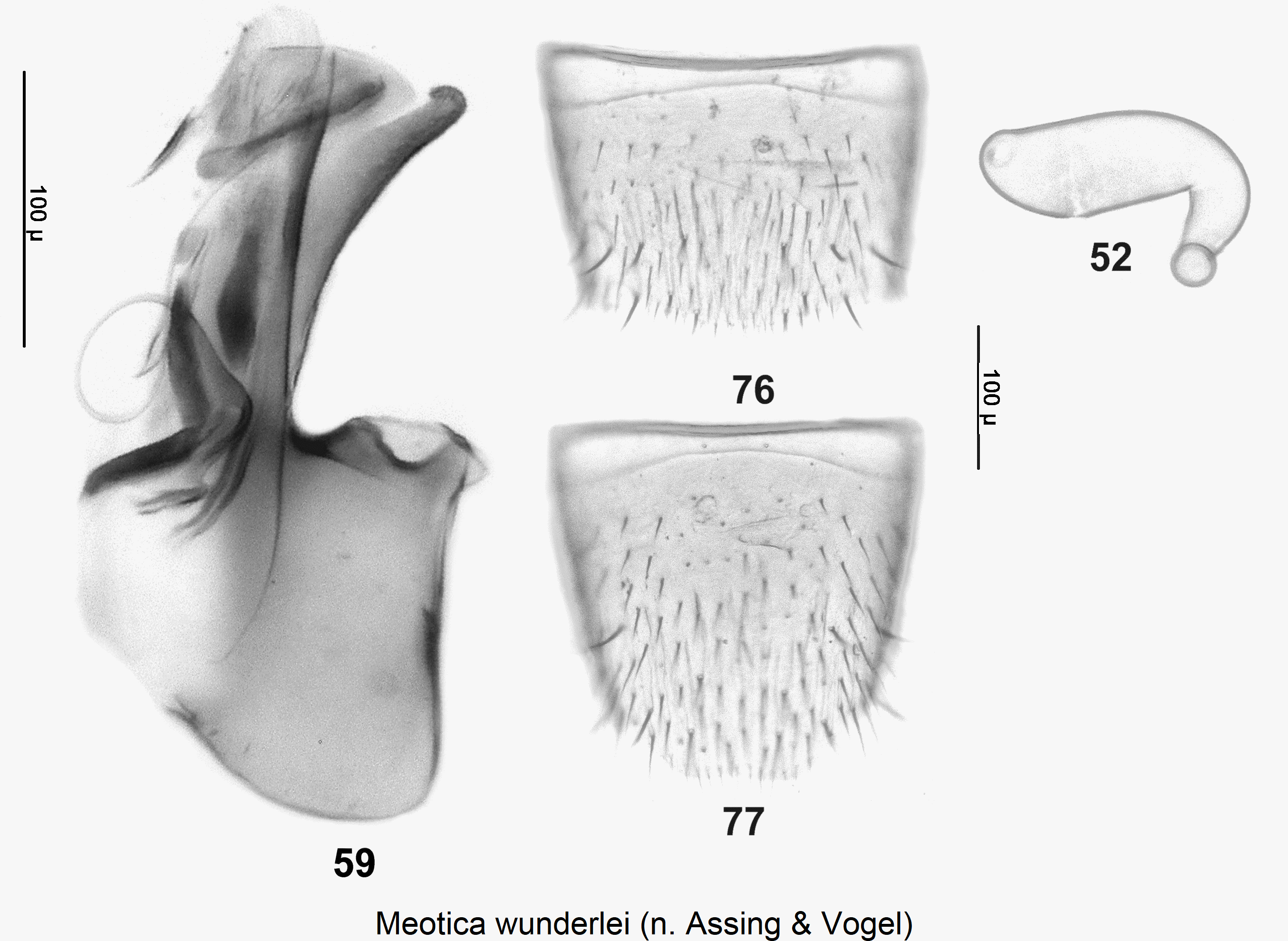 meotica_wunderlei_sperm.gif