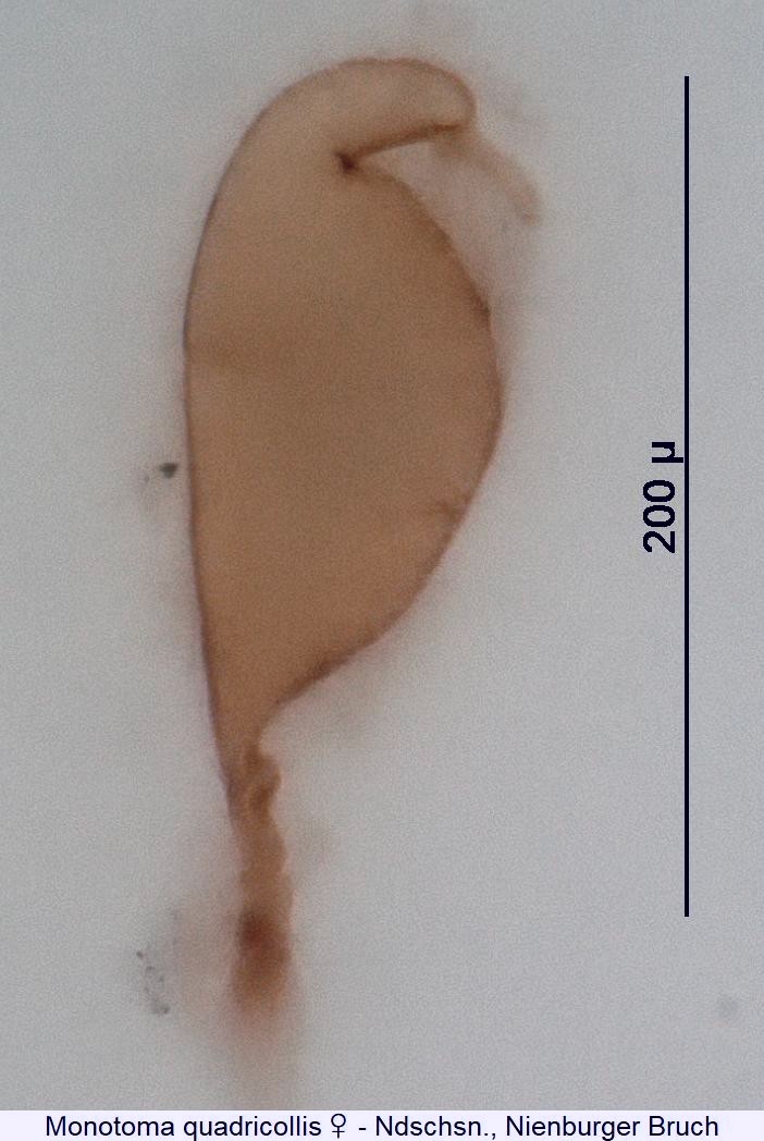 monotoma_quadricollis_w_sperm.jpg
