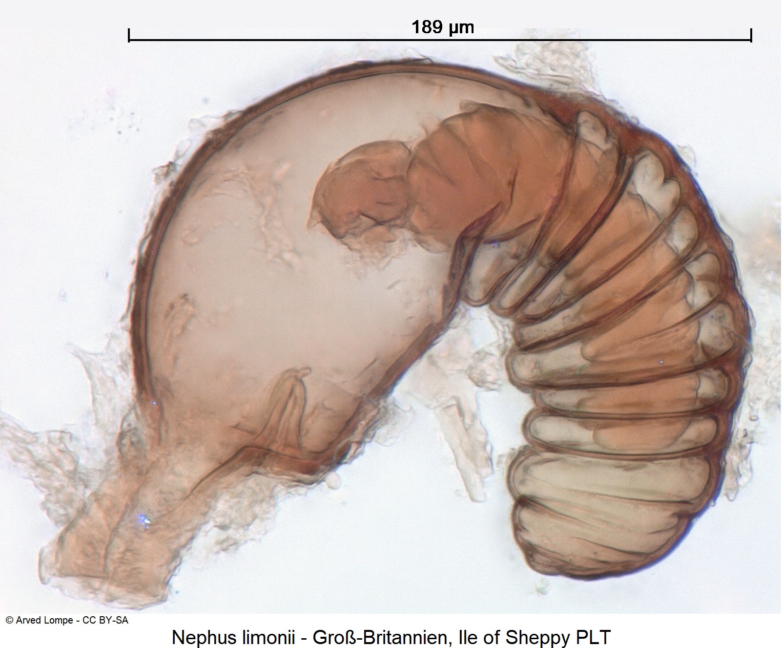 nephus_limonii_ck37277255_sperm.jpg