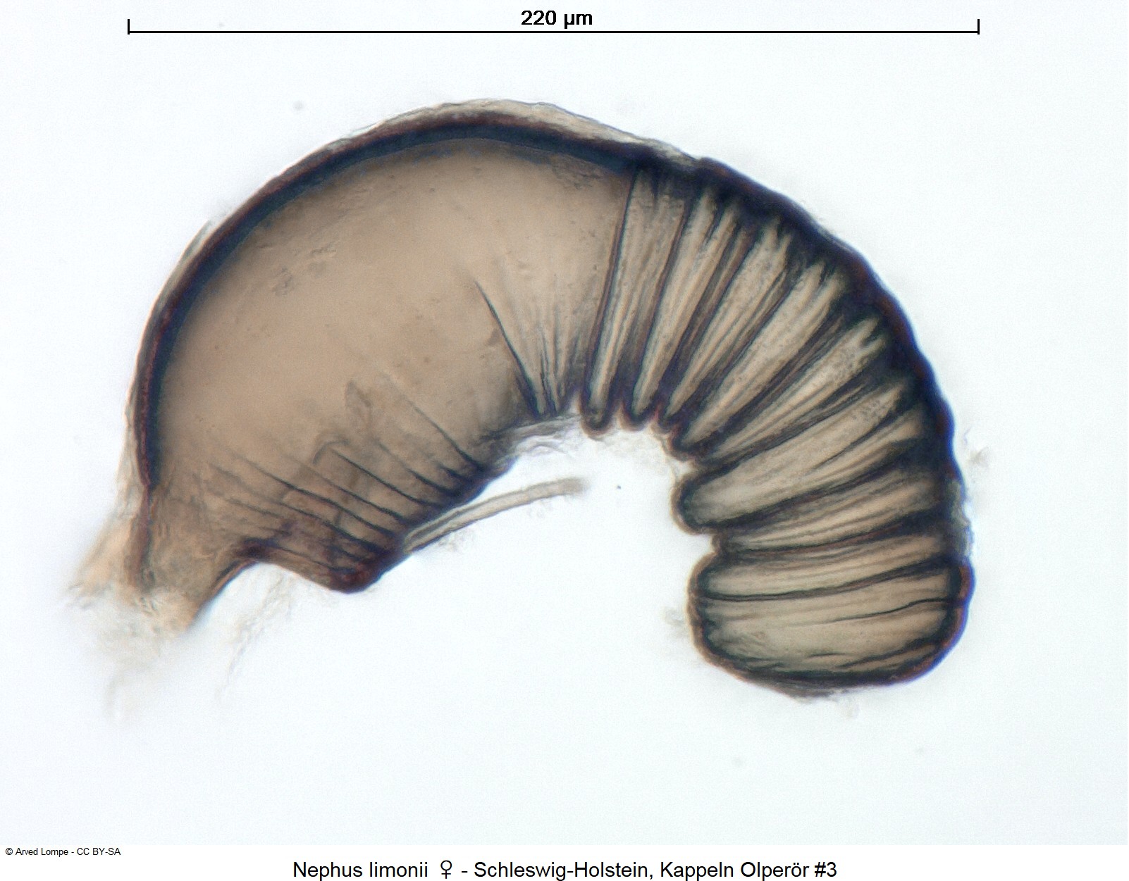 nephus_limonii_w_nr3_sperm.jpg