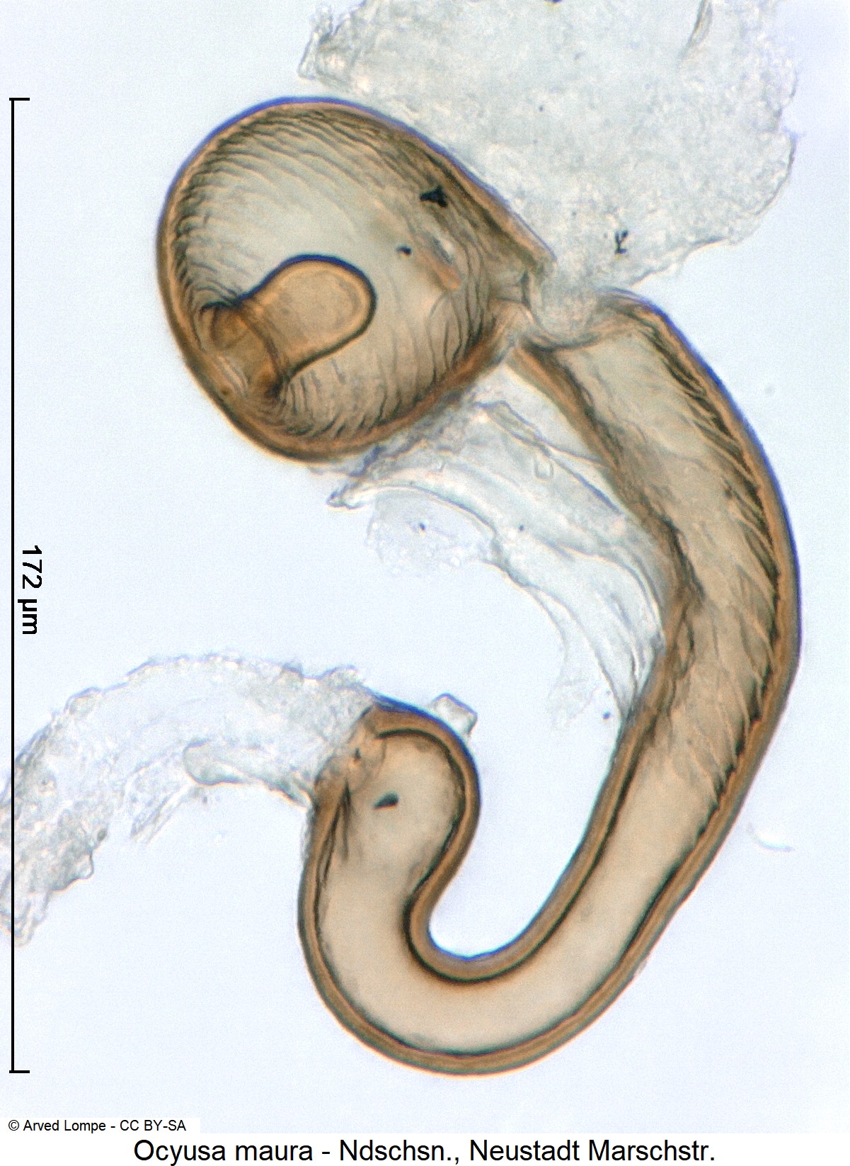 ocyusa_maura_$7999176_sperm.jpg