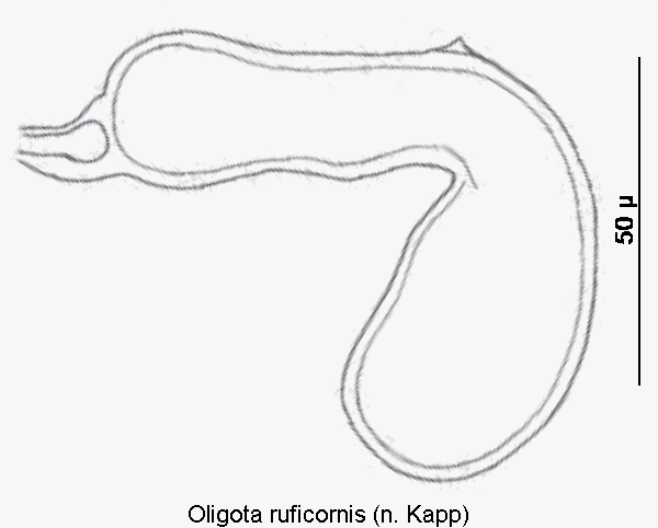 oligota_ruficornis_sperm.gif