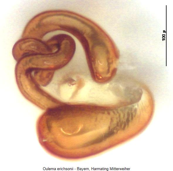 oulema_erichsonii_sperm1.jpg