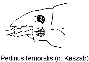 pedinus_femoralis_k.gif