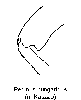 pedinus_hungaricus_hschl.gif