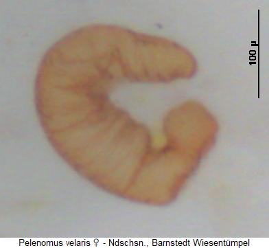 pelenomus_velaris_sperm.jpg