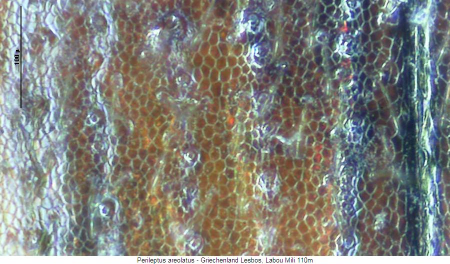 perileptus_areolatus_ms.jpg