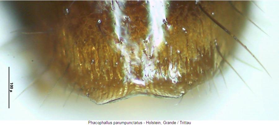 phacophallus_parumpunctatus_sternit.jpg