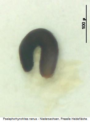 pselaphorhynchites_nanus_sperm.jpg