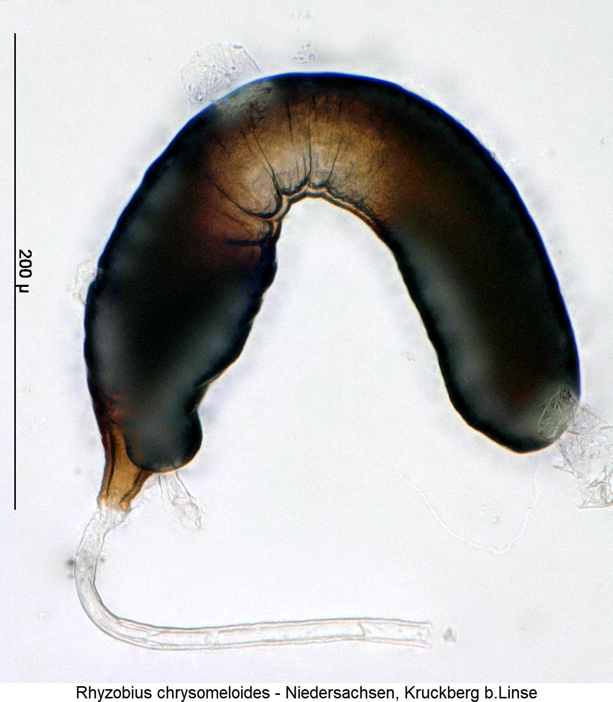 rhyzobius_chrysomeloides_sperm.jpg