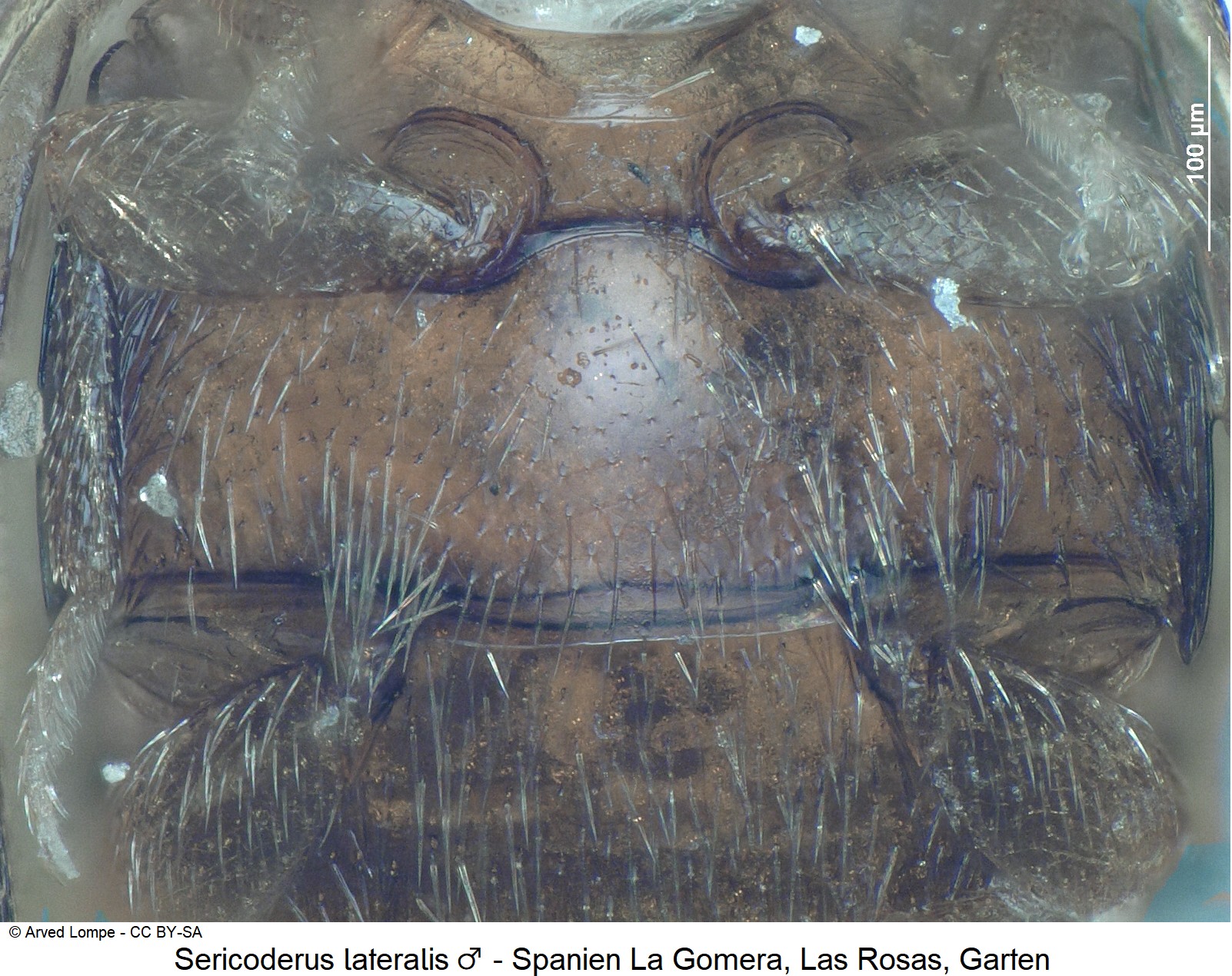 sericoderus_lateralis_m_ck7389080_hbr.jpg