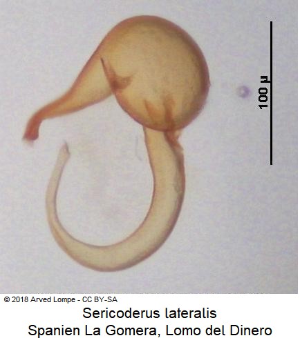 sericoderus_lateralis_sperm-2.jpg